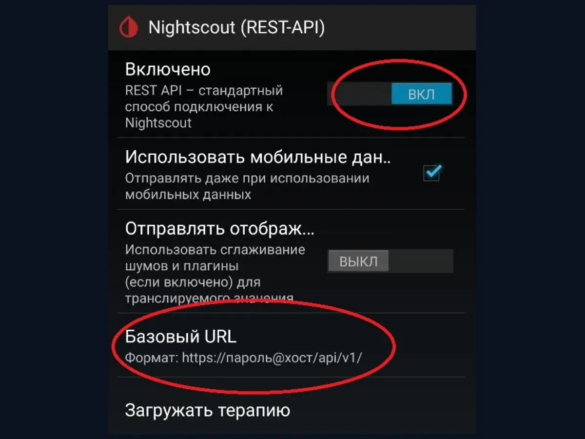 xDrip+ REST API и Базовый URL